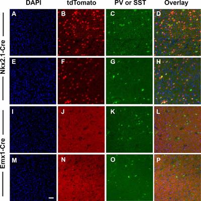 Behavioral and Neuroanatomical Consequences of Cell-Type Specific Loss of Dopamine D2 Receptors in the Mouse Cerebral Cortex